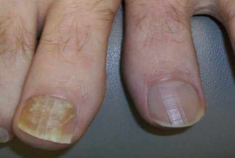 How to cure nails after building