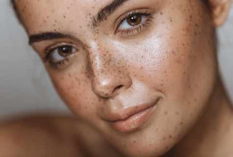 How to clean face freckles