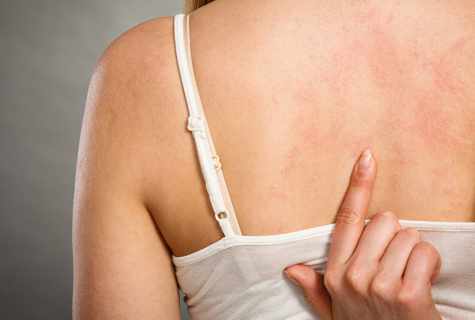 How to get rid of rashes on skin