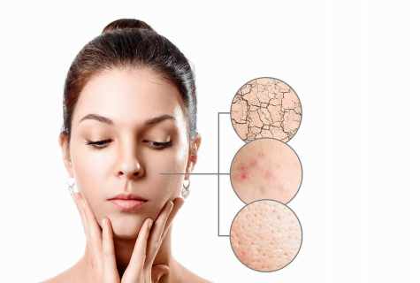 Causes of peeling of face skin