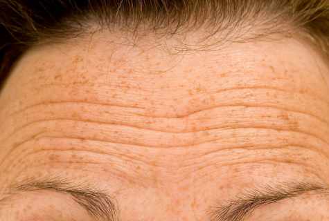 How to smooth wrinkles on forehead