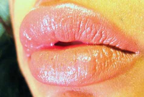 How to make lips healthy and beautiful
