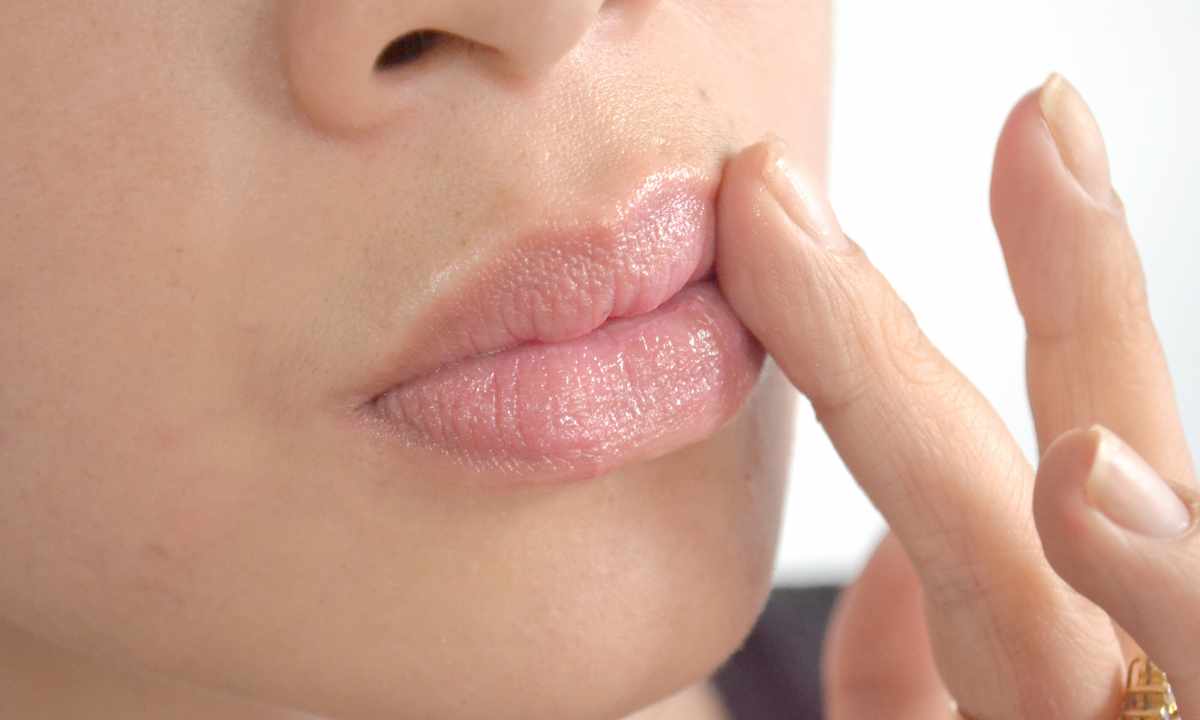 How to treat the cracked lips