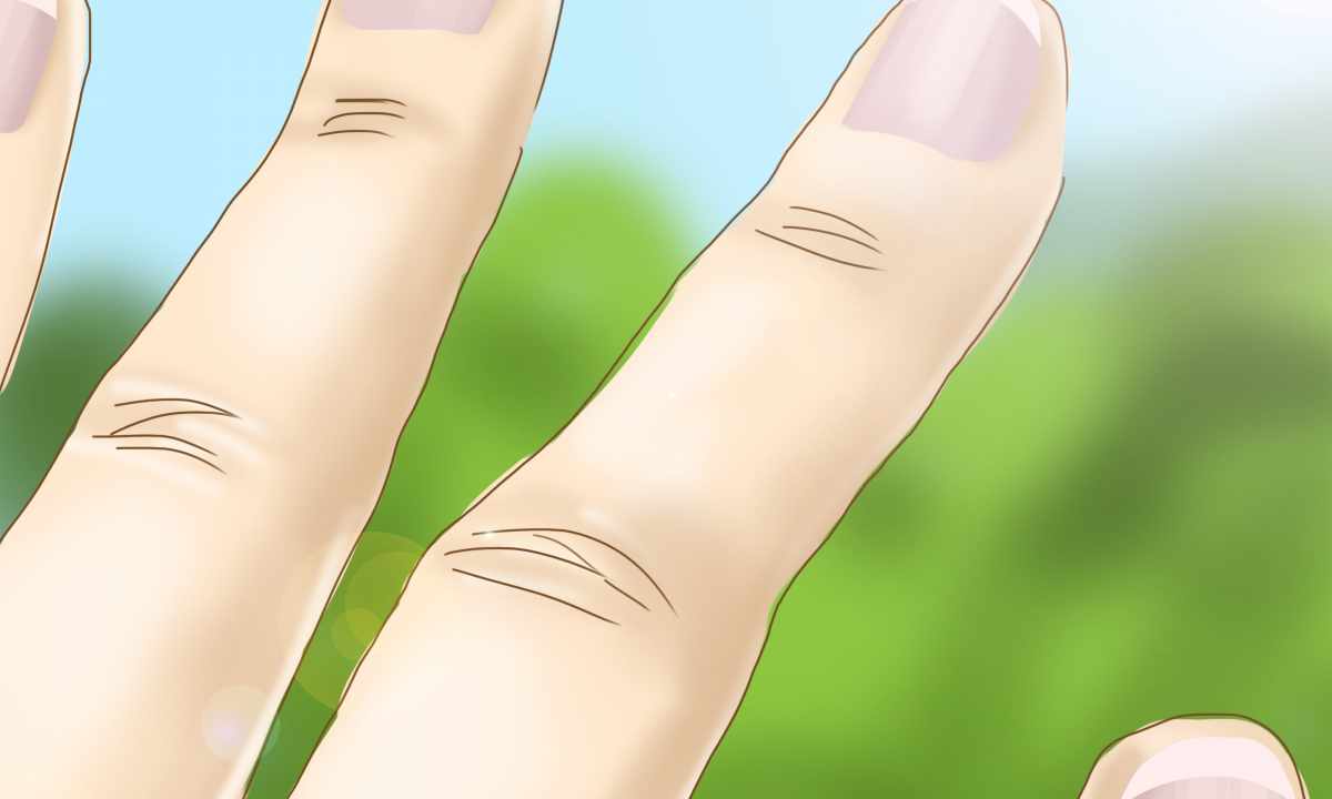 How to get rid of yellow nails