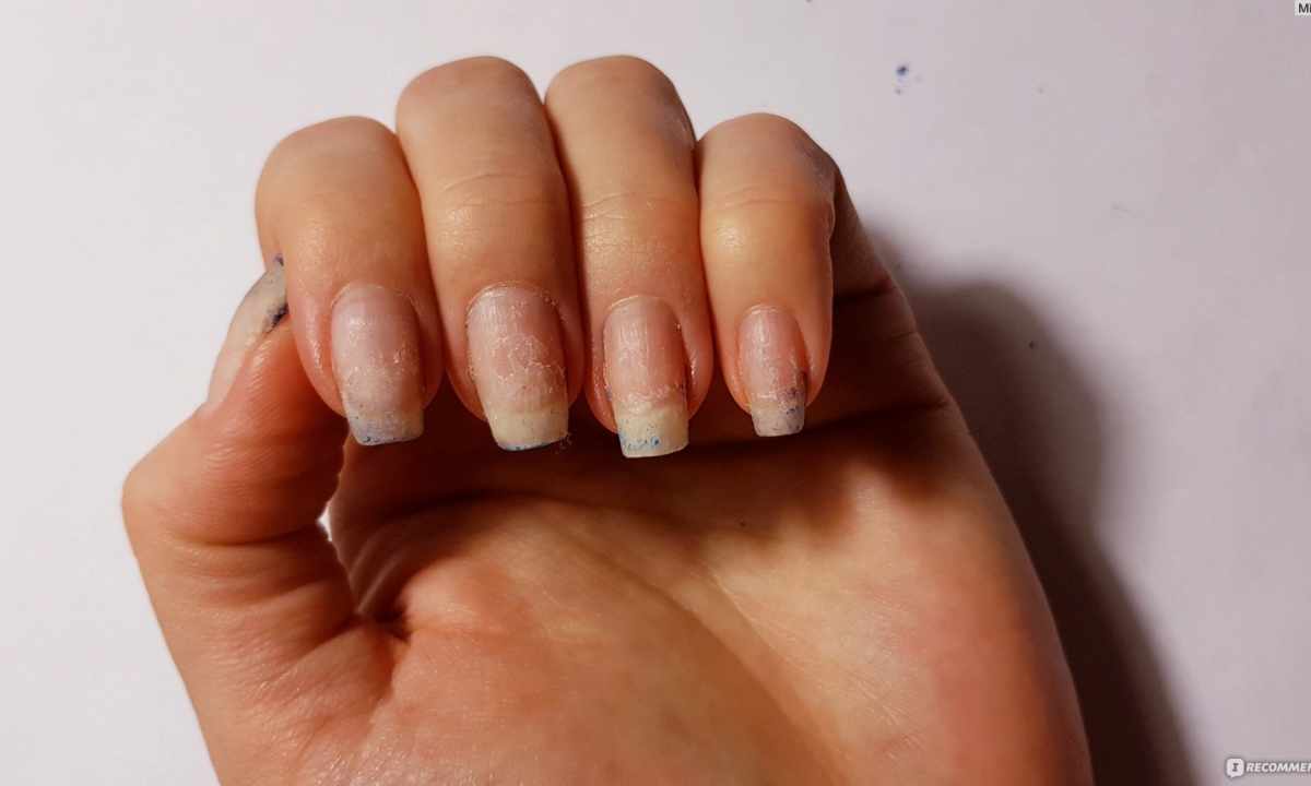 How to recover the injured nails after shellac