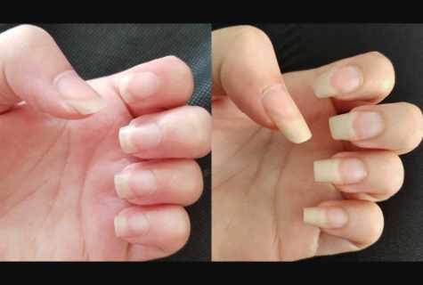 How quickly to grow nails and to make them strong