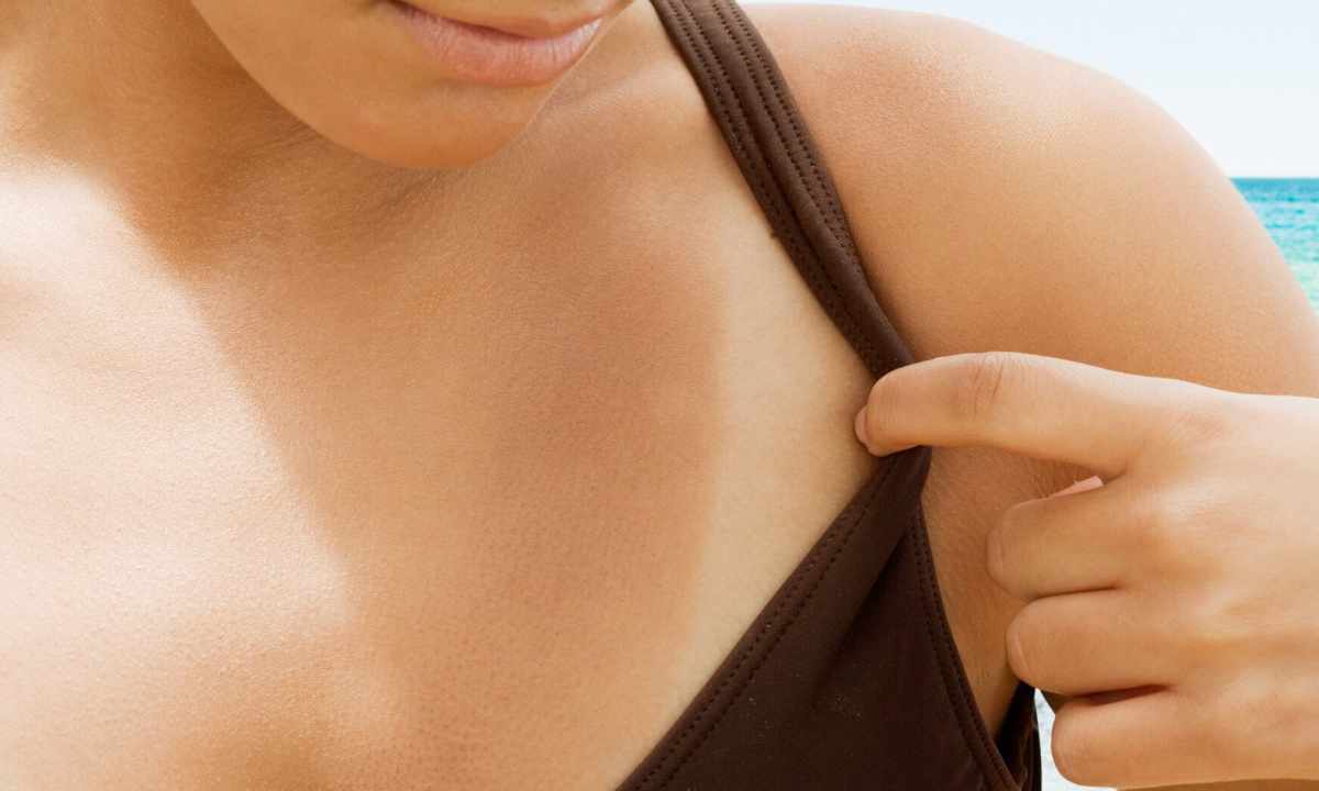 How to get rid of suntan
