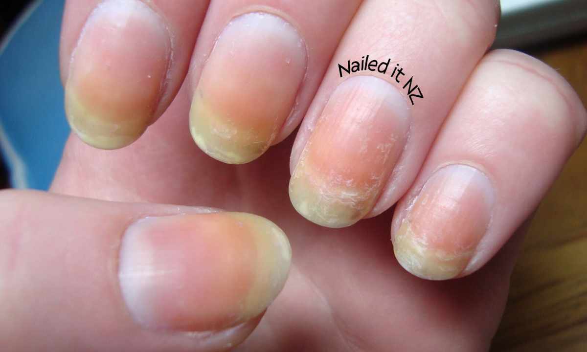 Why nails turn yellow
