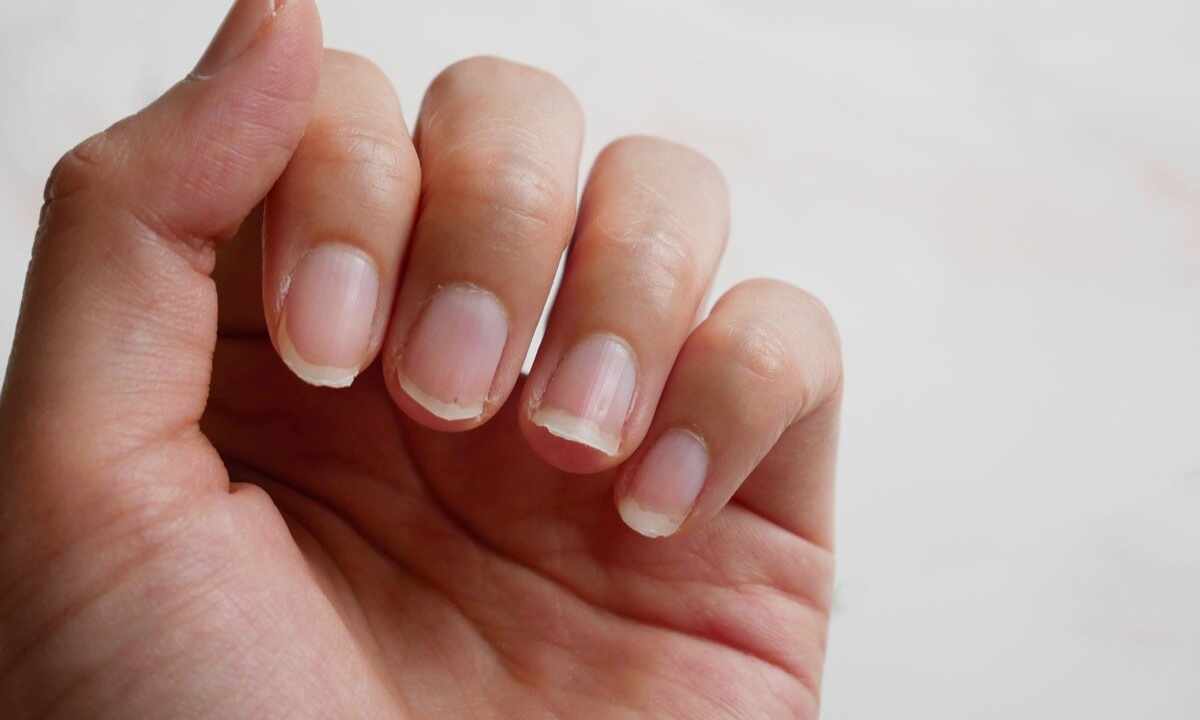 How to strengthen fragile nails