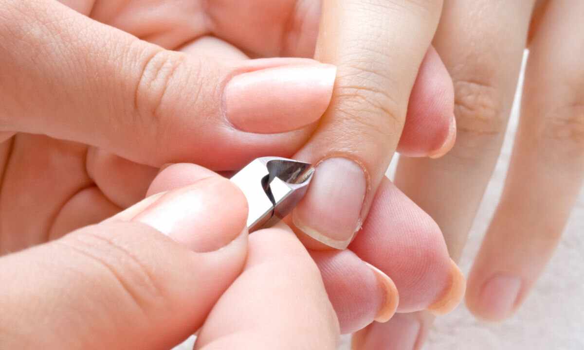 How to get rid of hangnails