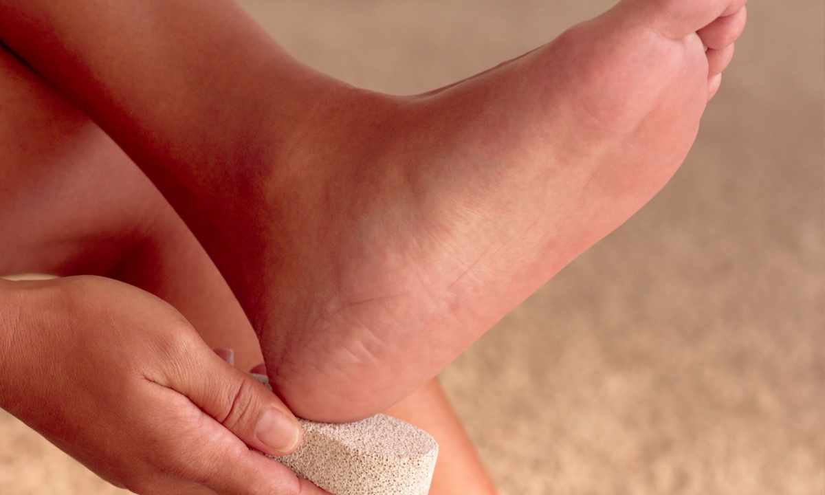 How to treat cracks on heels folk remedies
