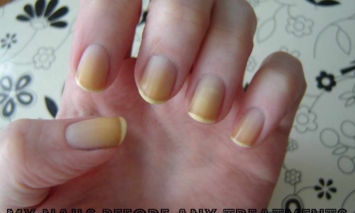How to remove yellowness on nails