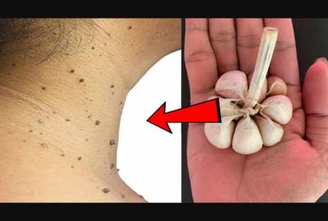 How to remove shortcomings from skin