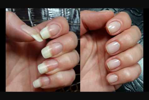 How for a long time to keep healthy nails, despite artificial covering