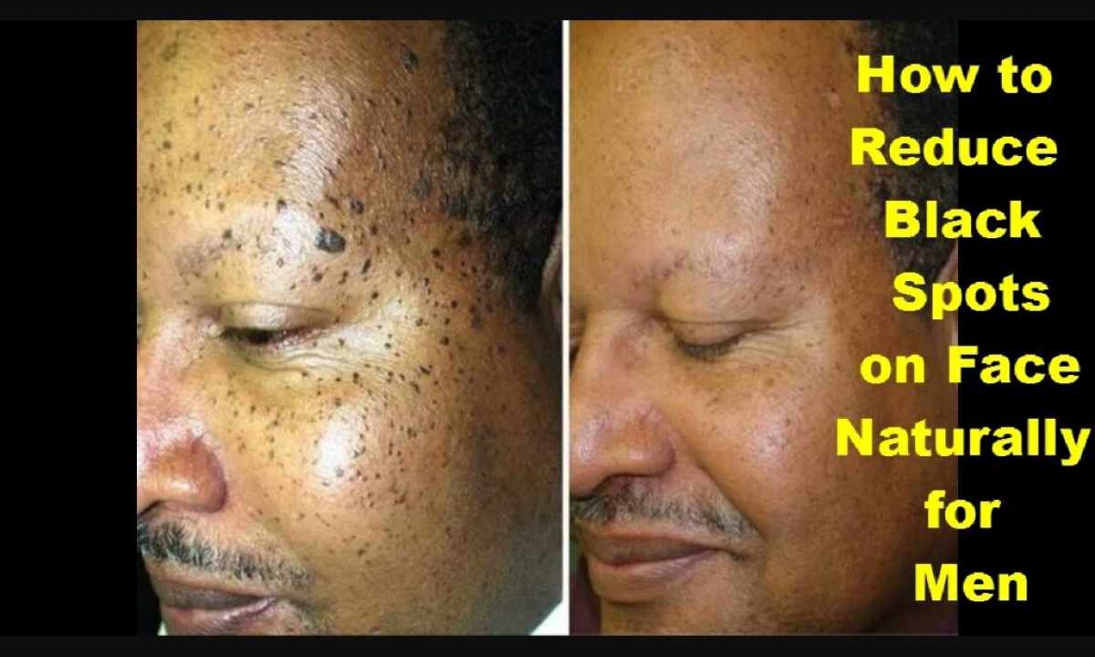 How to remove fat spot from skin