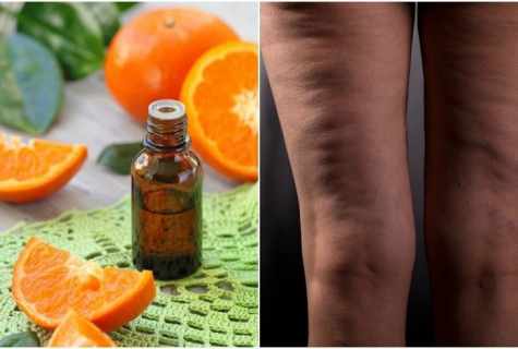 What essential oils will help to get rid of cellulitis