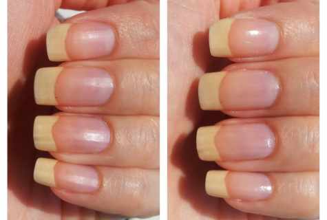 How to bleach yellow nails after varnish