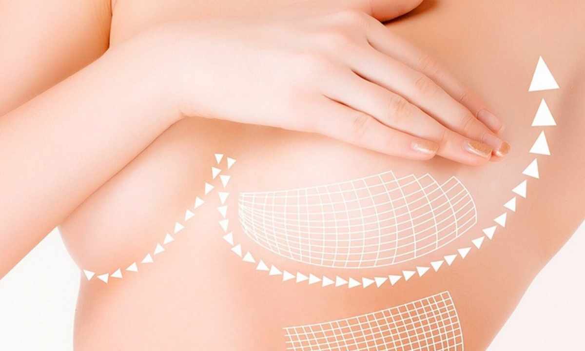 Correct breast care and zone of decollete