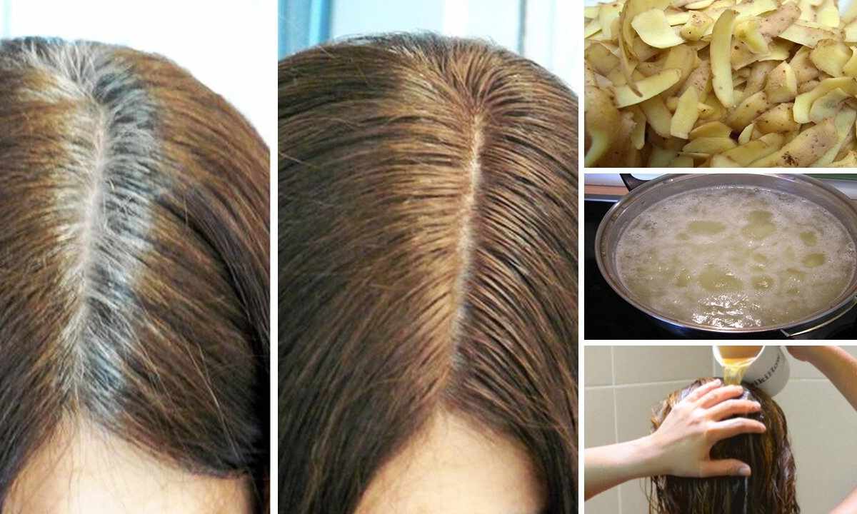 How to get rid of growing of hair