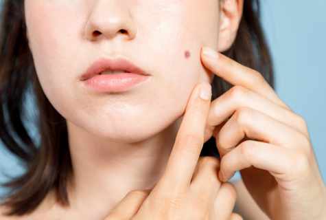 How to get rid of pimples on hands