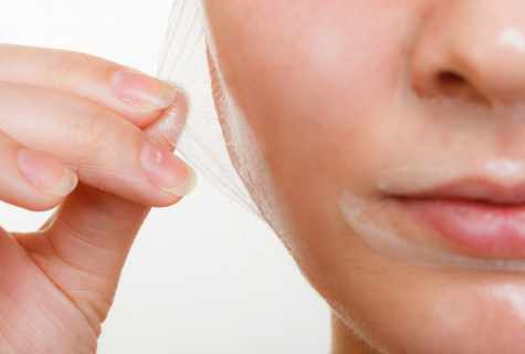 How to get rid of skin peeling
