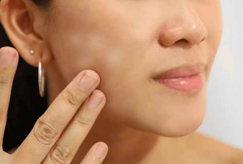 How to get rid of white spots on skin