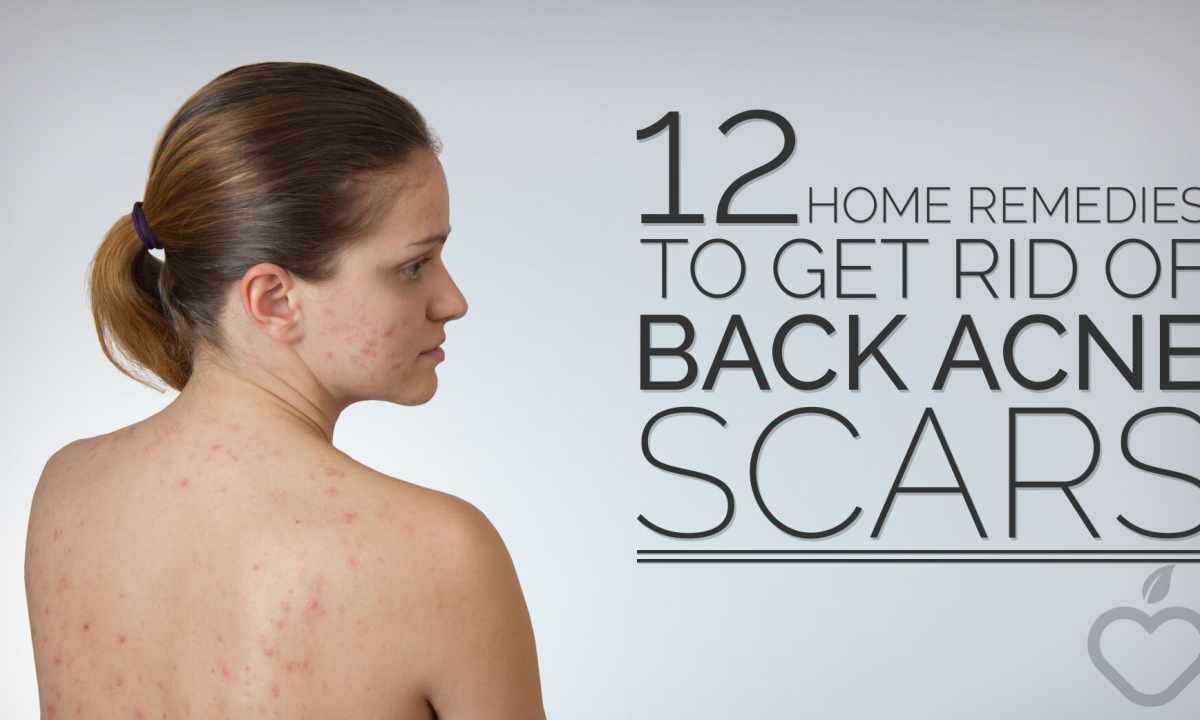 How to get rid of scars standing