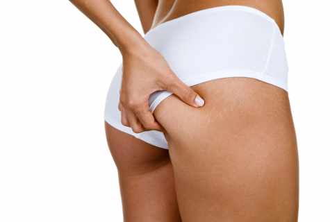 How to get rid of callosities on buttocks