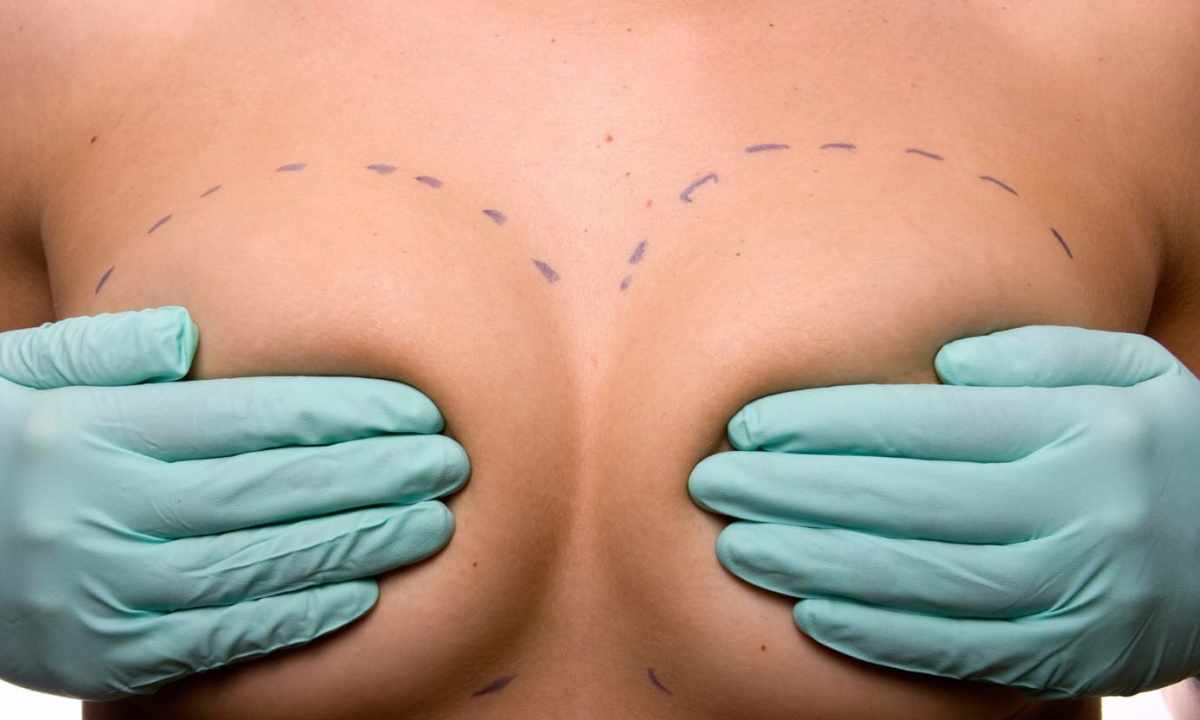 How to reduce breast without operation
