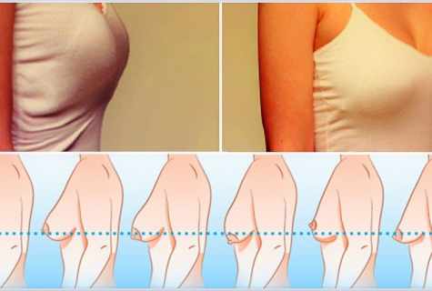 How to change shape of breast