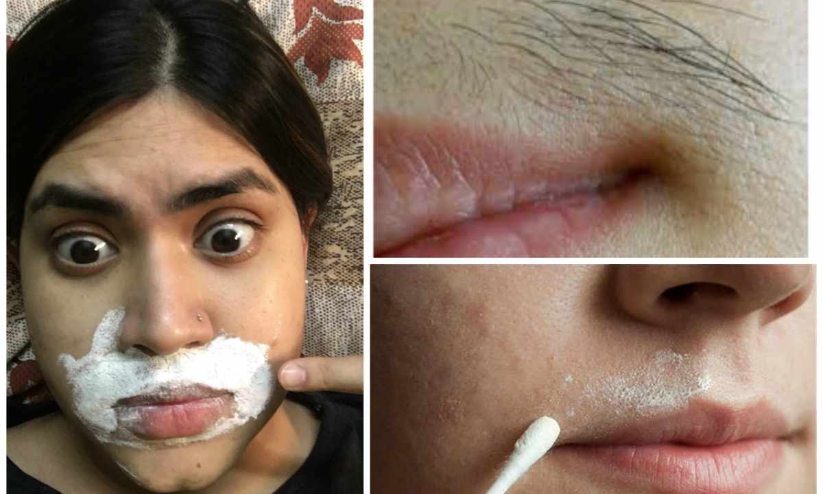 How to get rid of face hair forever in house conditions