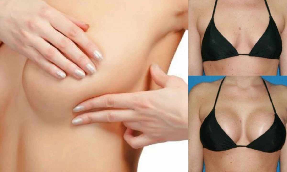 How to keep breast tightened and beautiful