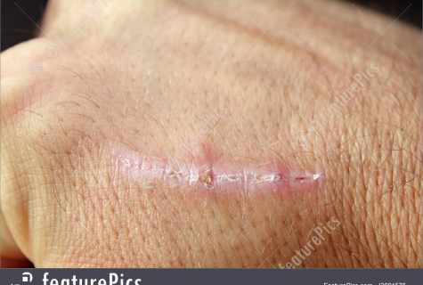 How to remove traces from hems and scars? The best means