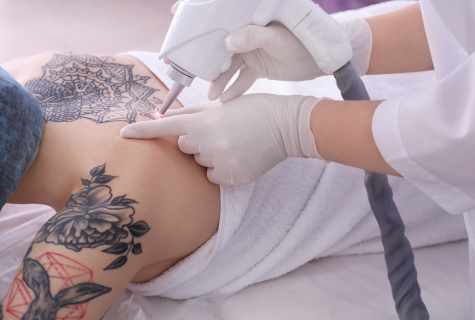 How to reduce tattoo: ways of removal of tattoo