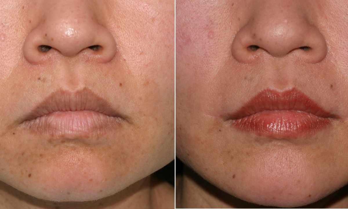How to lift corners of lips