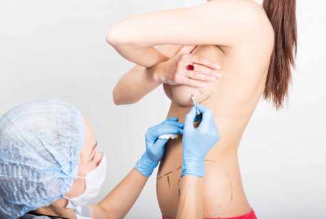 How to make correction of breast after the delivery