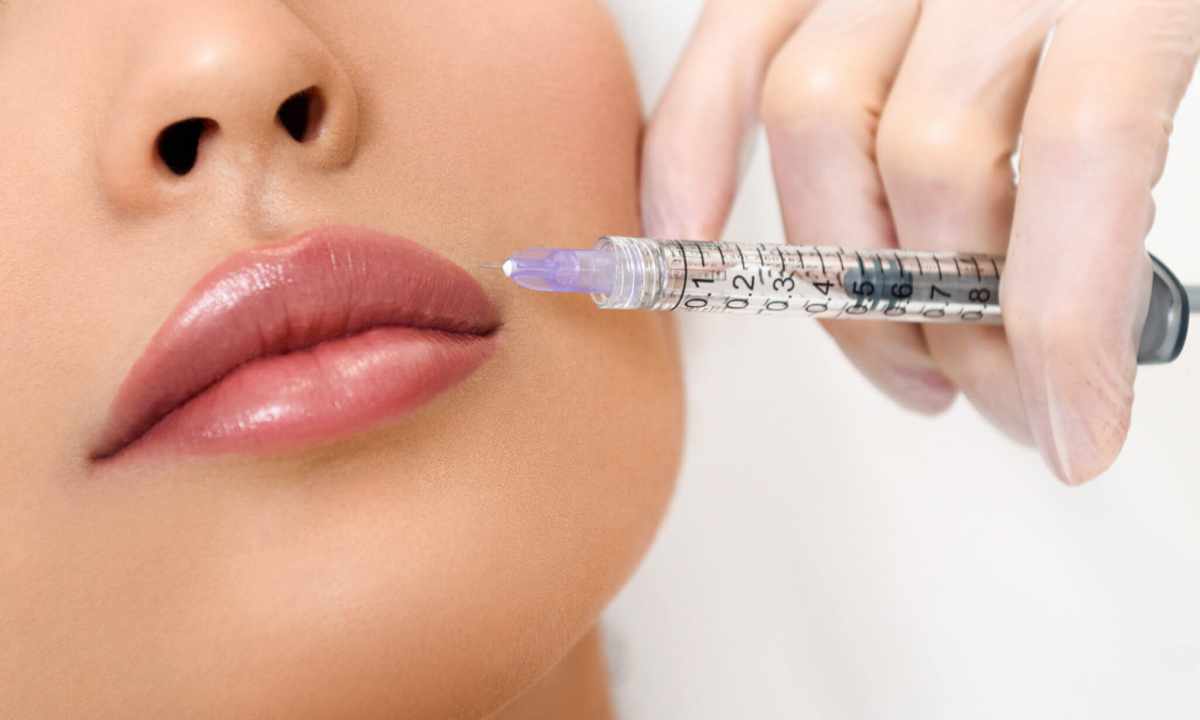How to increase lips by means of injections