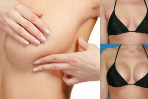 How to return former shape of breast