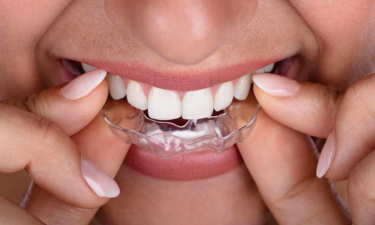 When it is possible to correct curvature of teeth
