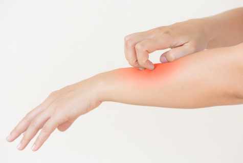 How to remove cellulitis from hands