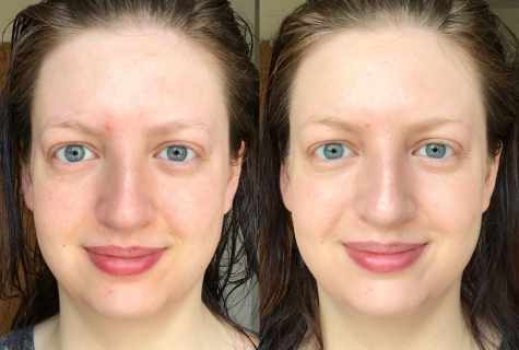 How to restore complexion