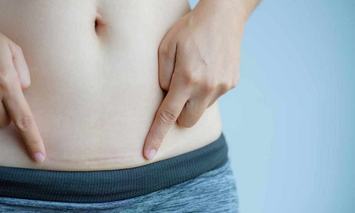 How to lose weight after Cesarean section