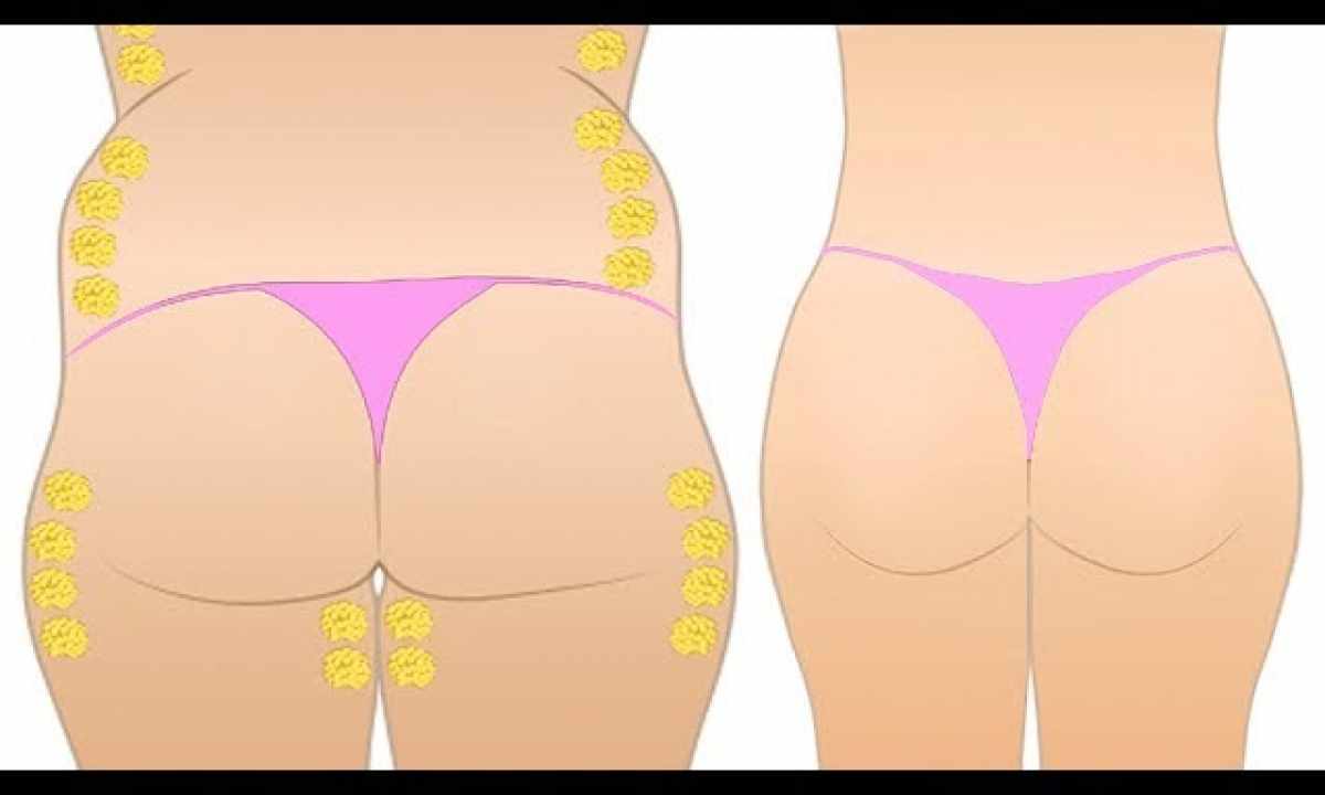 How to lose weight in hips and buttocks