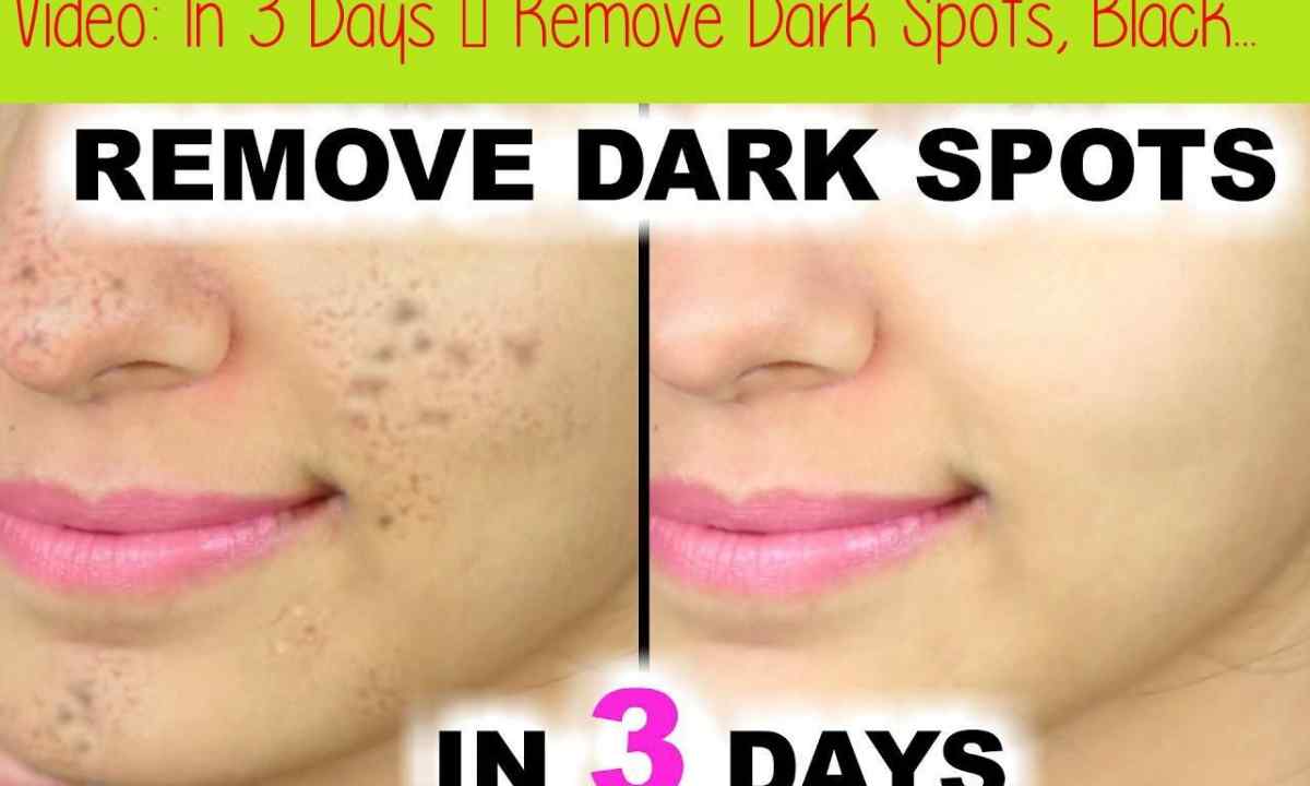 How to remove the eaten spots