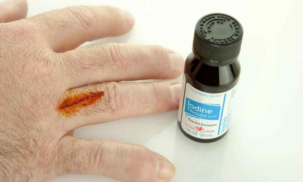 How to remove spot from iodine