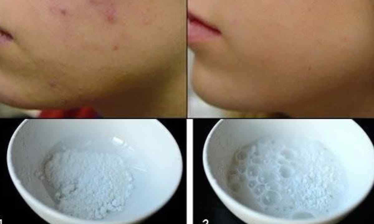How to remove spots from wax