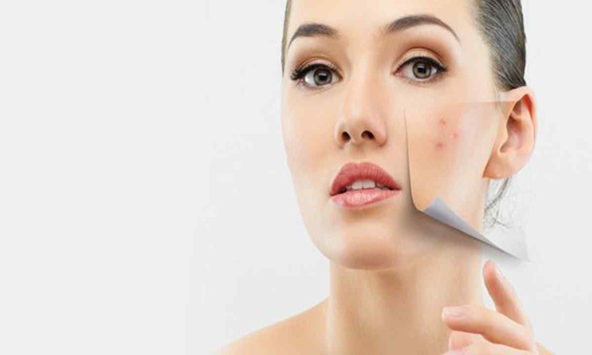 How to get rid of white spots