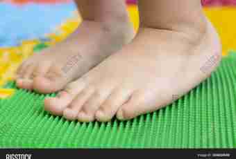 What exercises to do for treatment of flat-footedness at the child