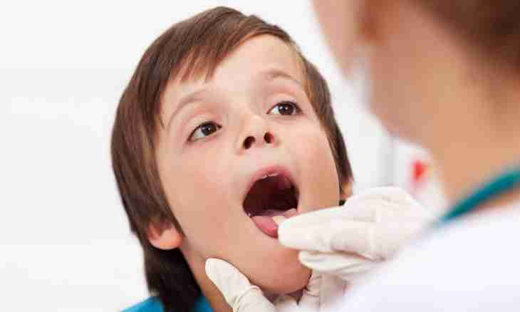How to treat tonsils at children