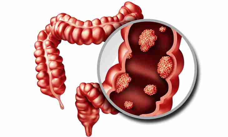 Problems with depletion of intestines at children: solutions